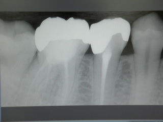 PICT0150.JPG